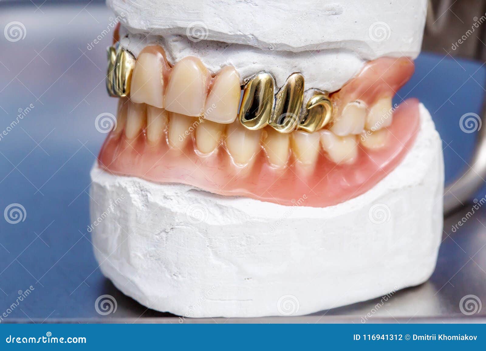 Dental Mold Dentist Clay Teeth Ceramic Plate Model Cast Stock Image - Image  of health, glove: 55520825