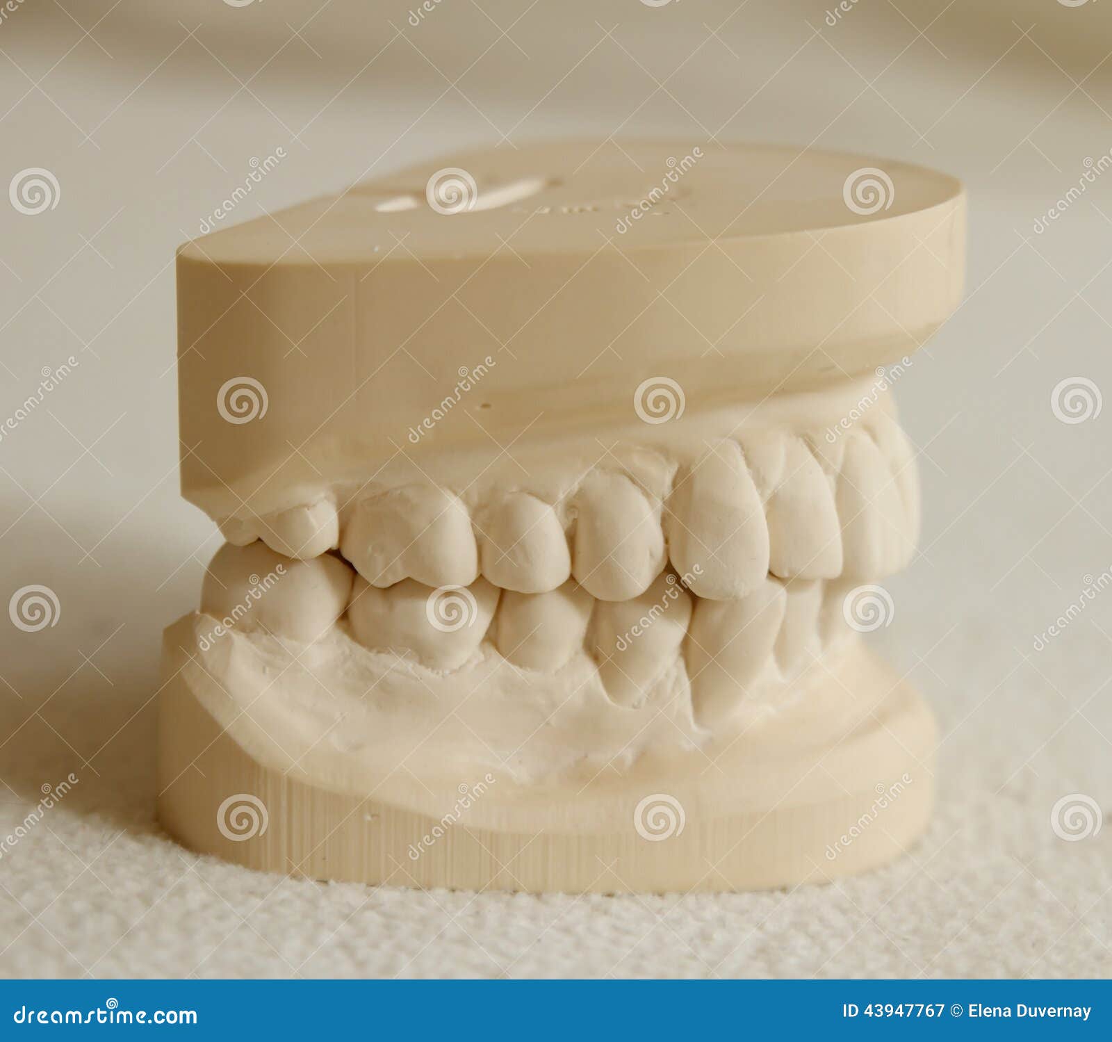 Dental Gypsum Model  Mould Of Teeth Stock Image Image of 