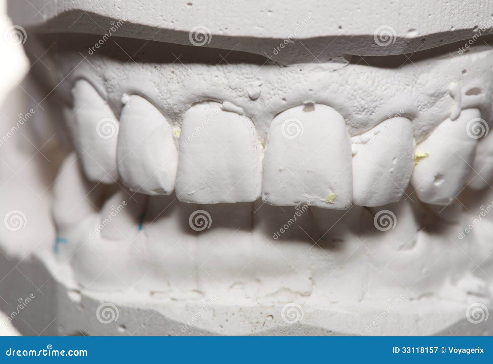 Dental Gypsum Model  Mould Of Teeth In Plaster Stock Image 