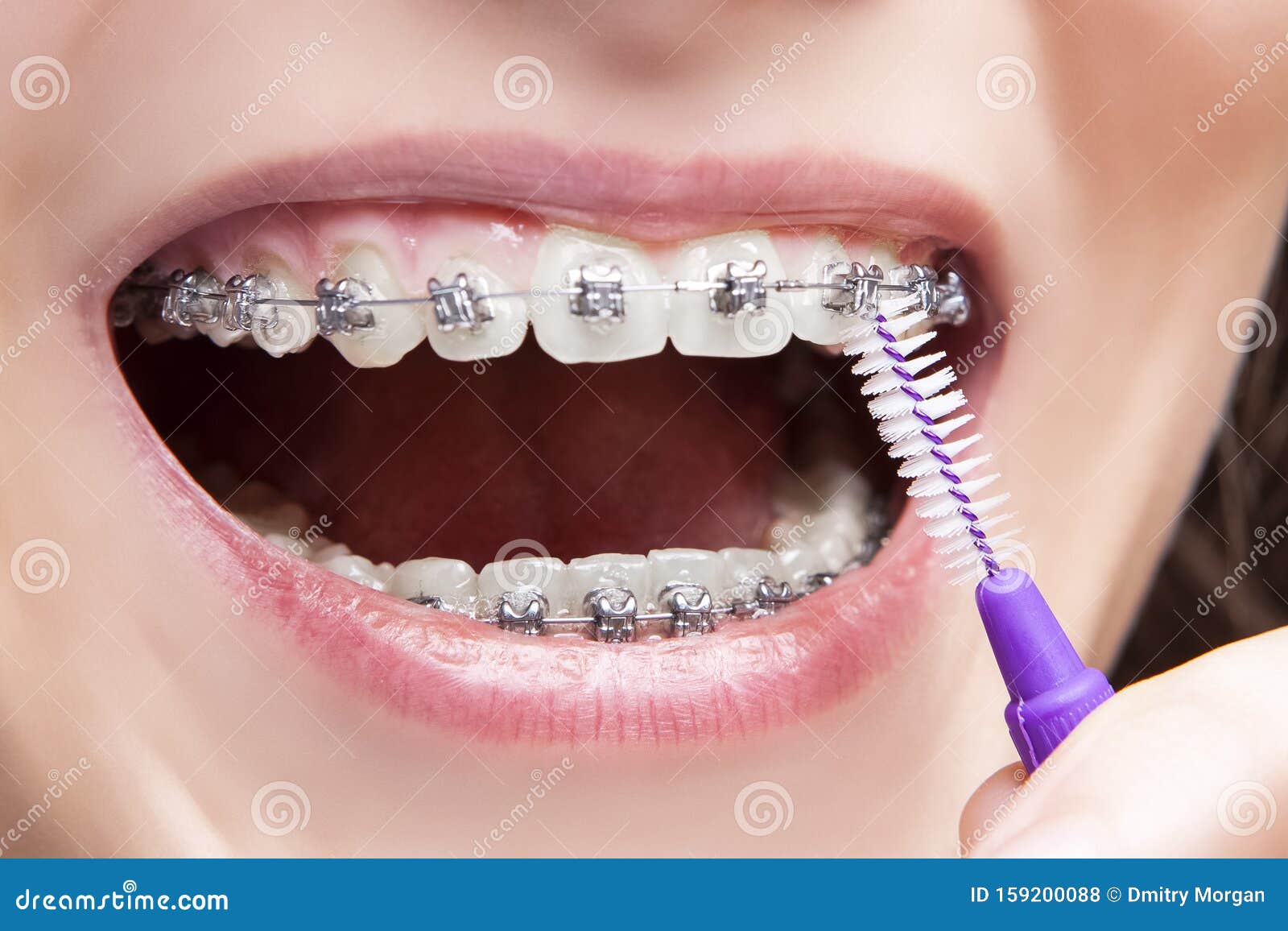 Dental Concepts. Caucasian Teenage Girl Using Bristle Brush For