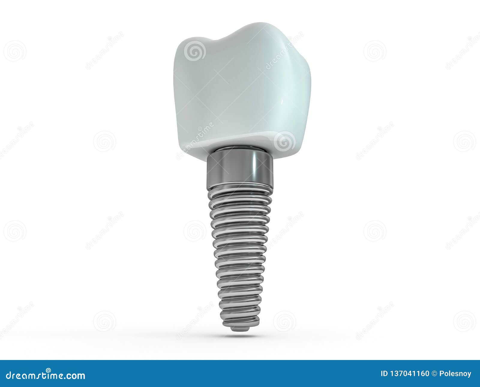 dental implant dentist, tooth layout, plastics, man, teeth, treatment. 3d