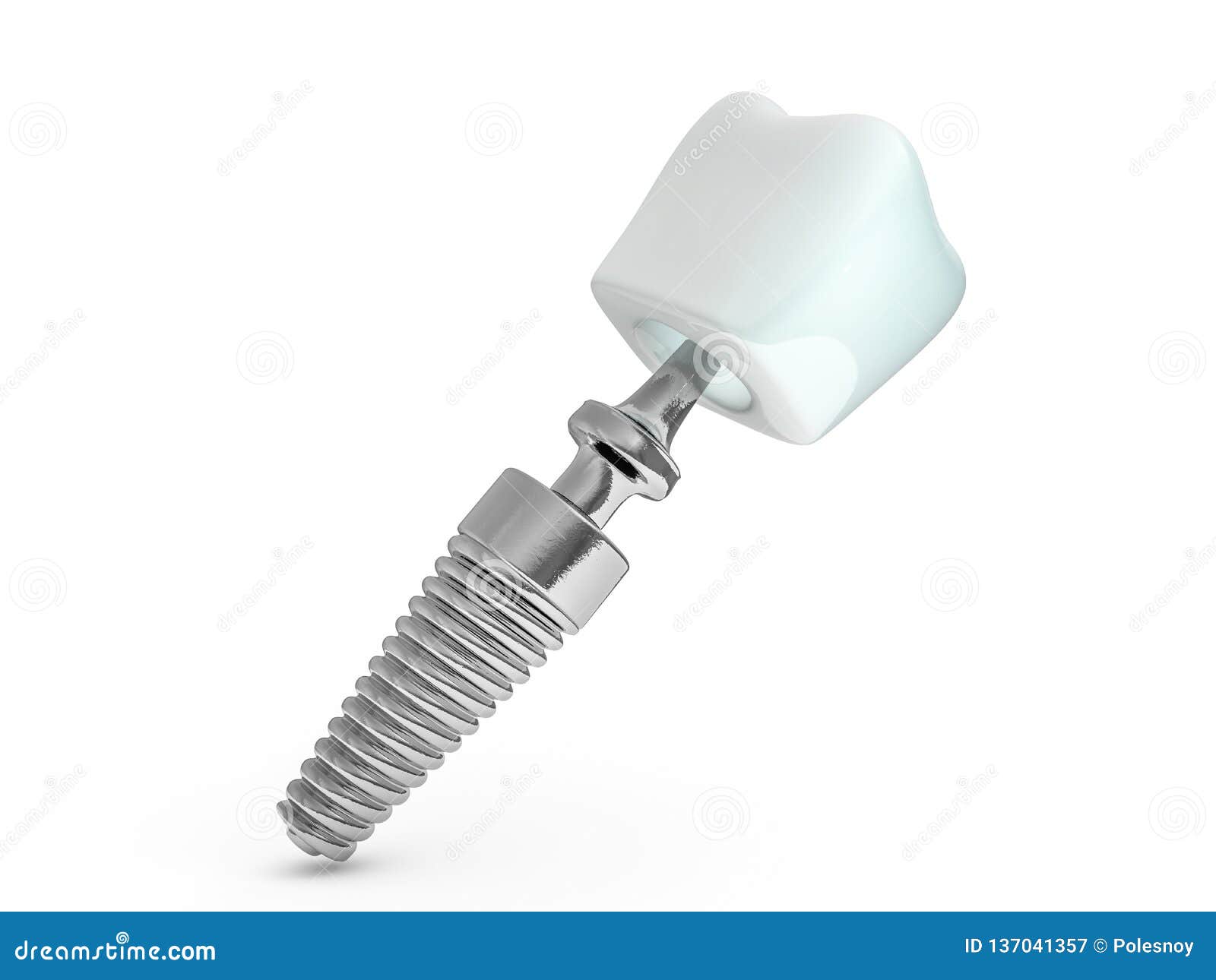 dental implant dentist, tooth layout, plastics, man, teeth, treatment. 3d