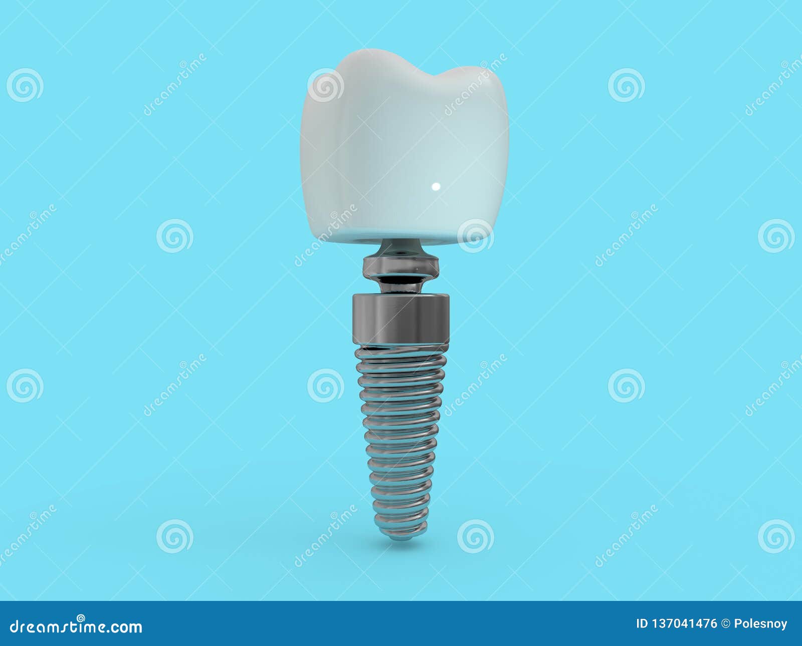 dental implant dentist, tooth layout, plastics, man, teeth, treatment. 3d