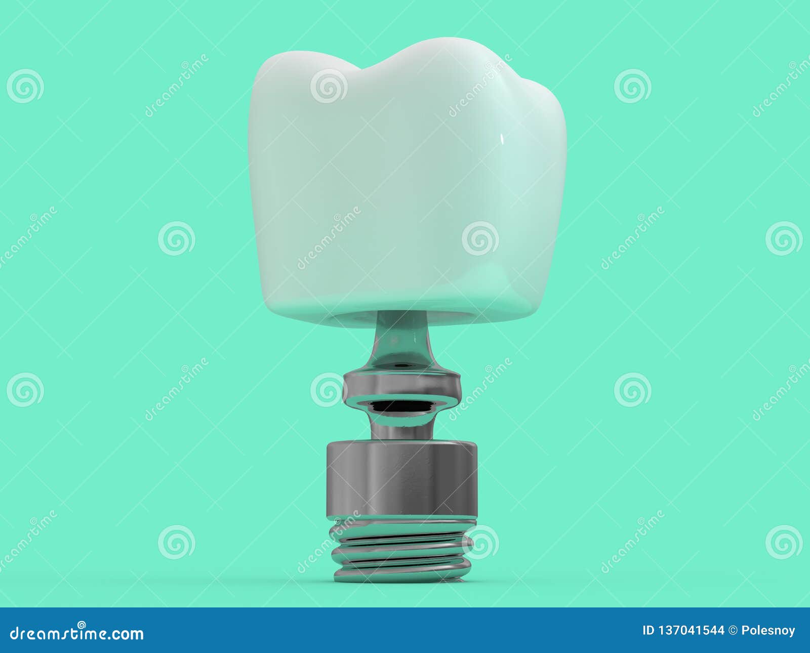 dental implant dentist, tooth layout, plastics, man, teeth, treatment. 3d