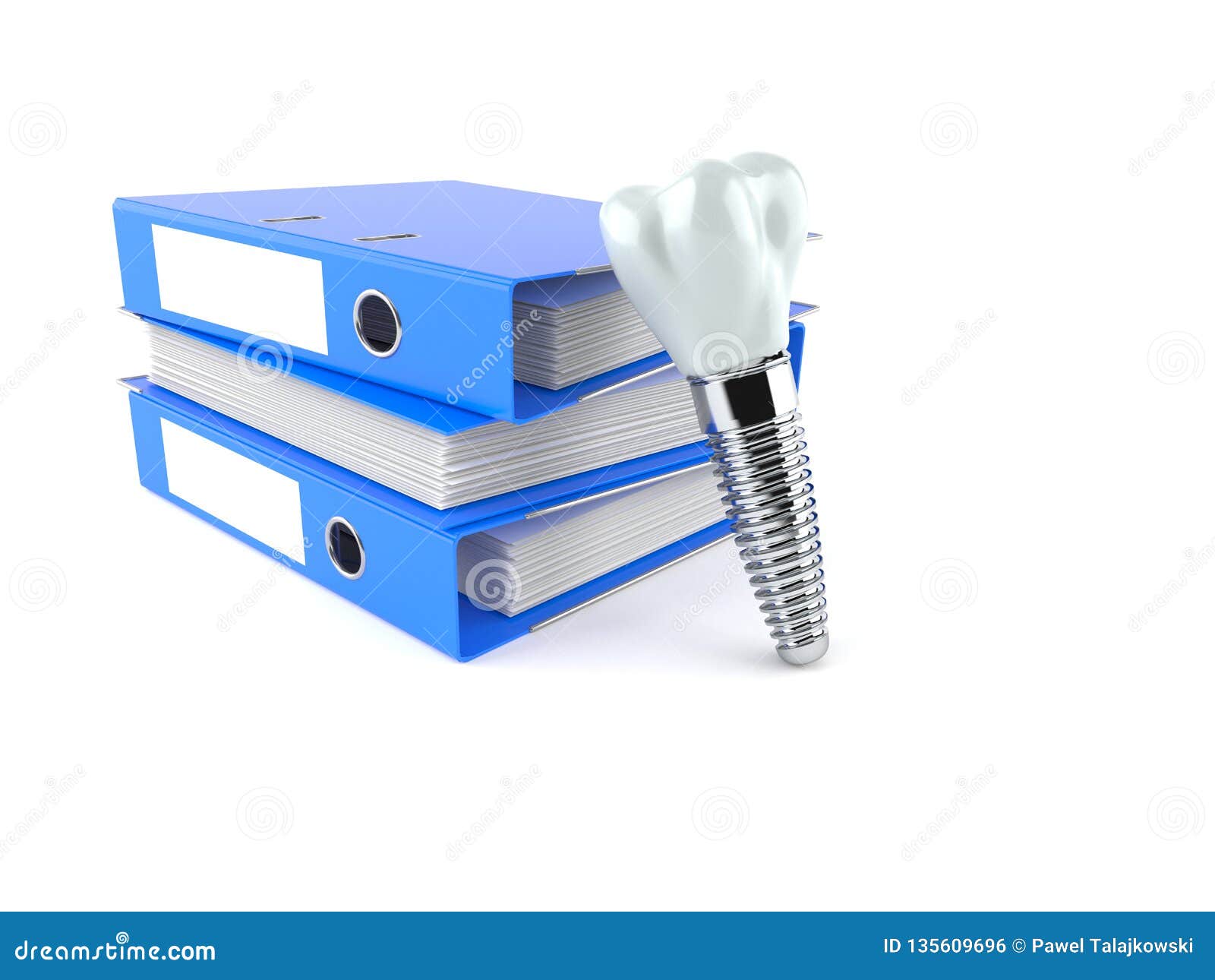 Dental Implant with Ring Binders Stock Illustration Illustration of