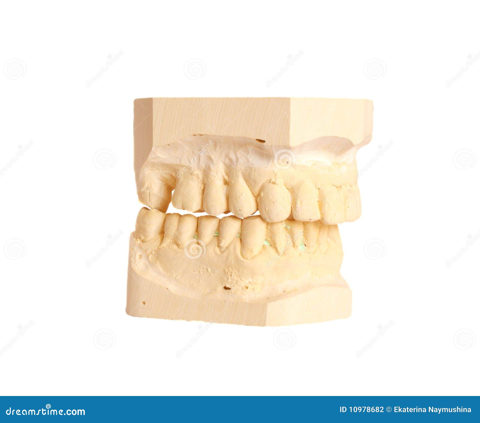 dental impression 4