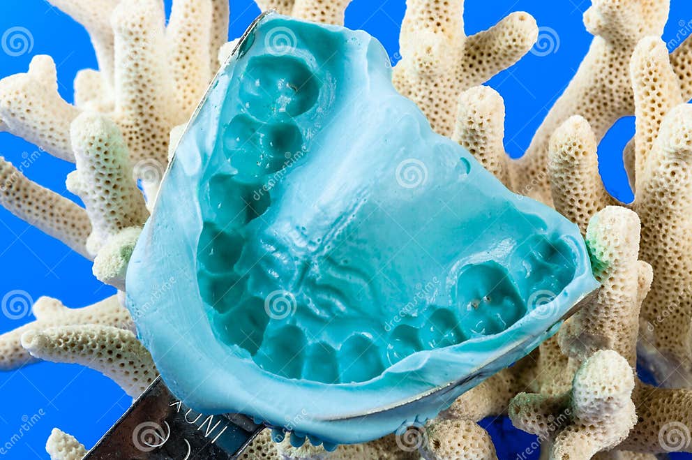 Dental impression stock image. Image of dental, denture 70880573