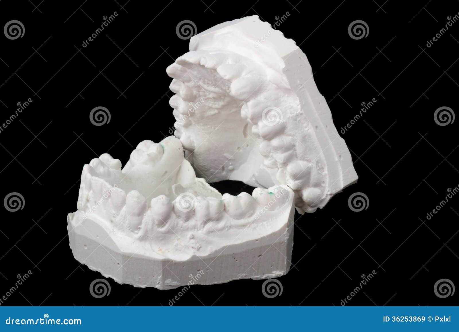 Dental Impression Chalk Model Stock Image Image of bridgework, chalk