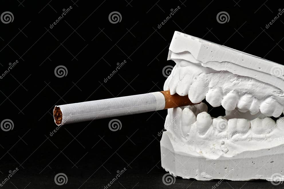 Dental Impression Chalk Model with Cigarette Stock Photo Image of