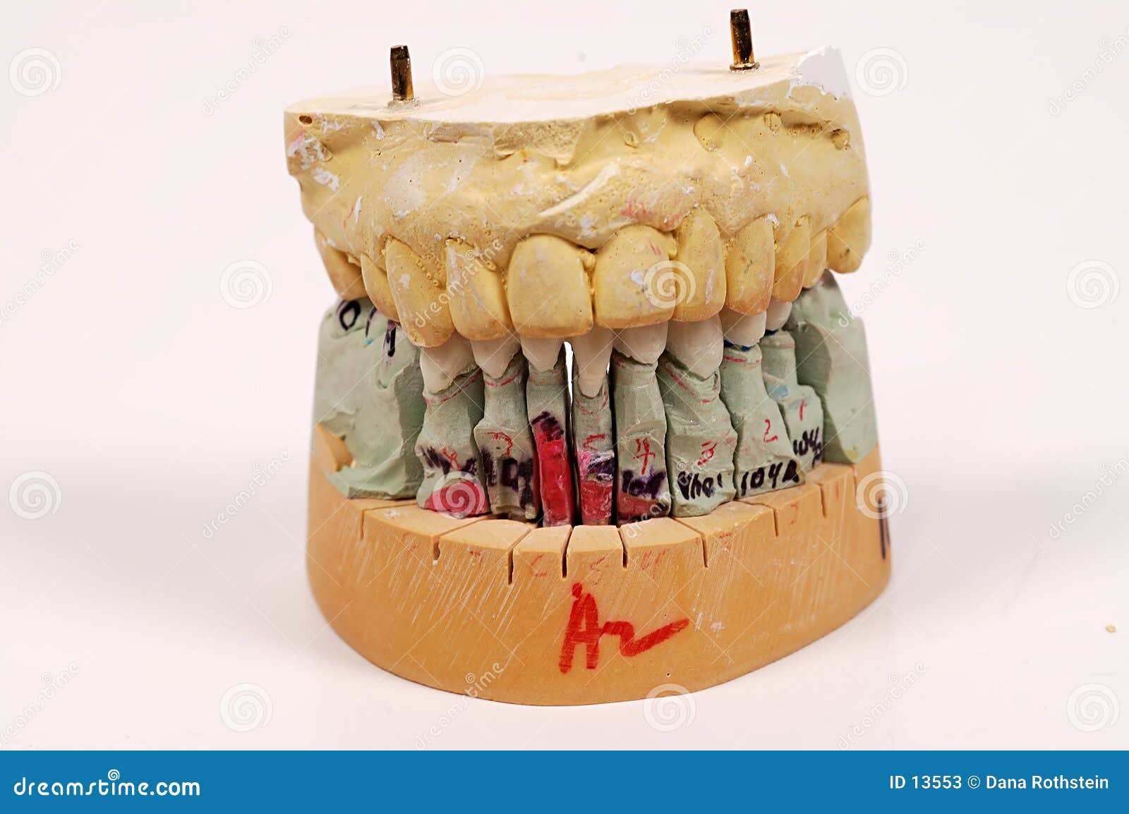 dental impressions