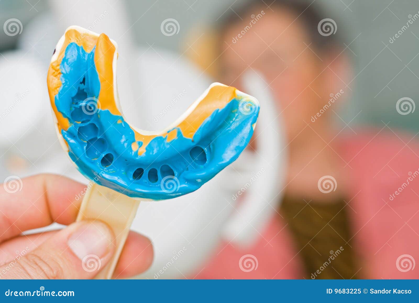 Dental imprint stock image. Image of medical, prothesis 9683225