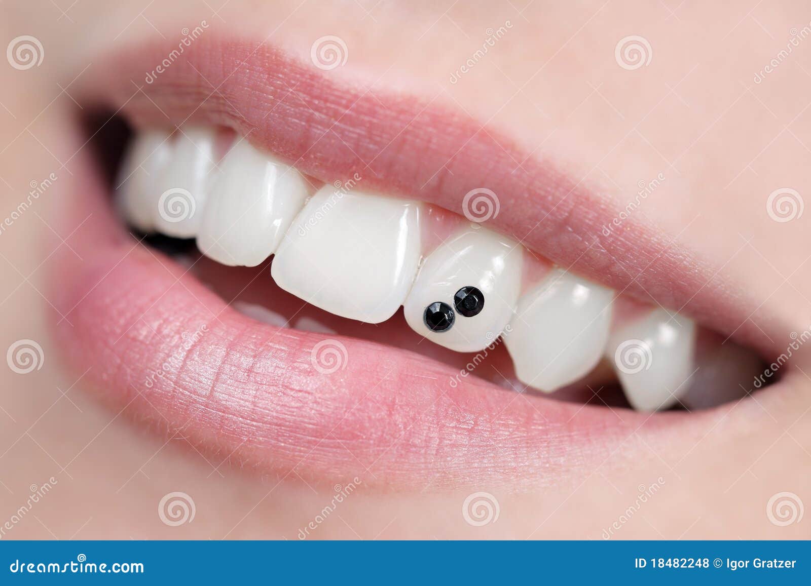Dental jewelry stock photo. Image of medicine, smile 18482248