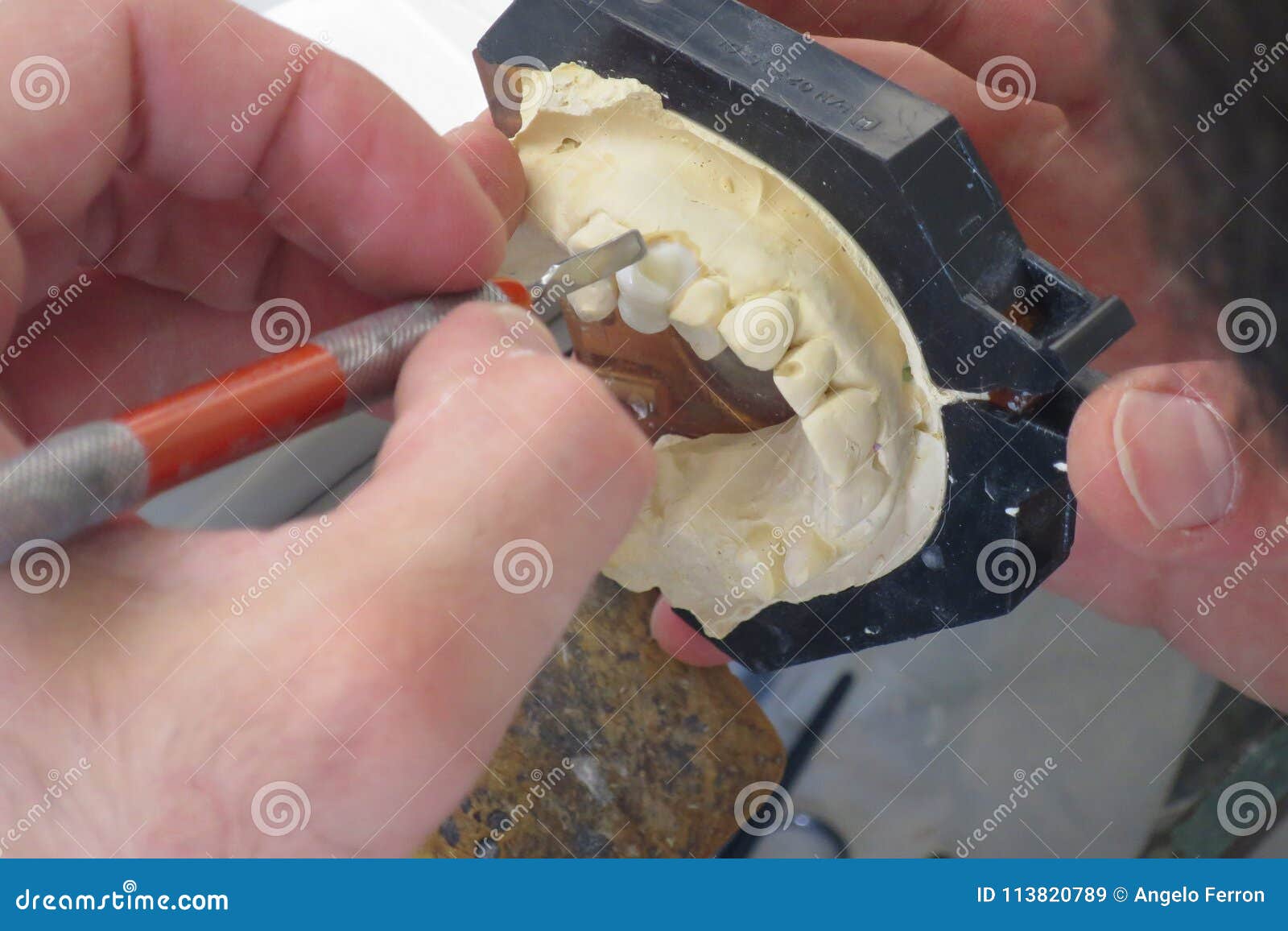 Dental Laboratory Equipment and Processing Stock Image Image of