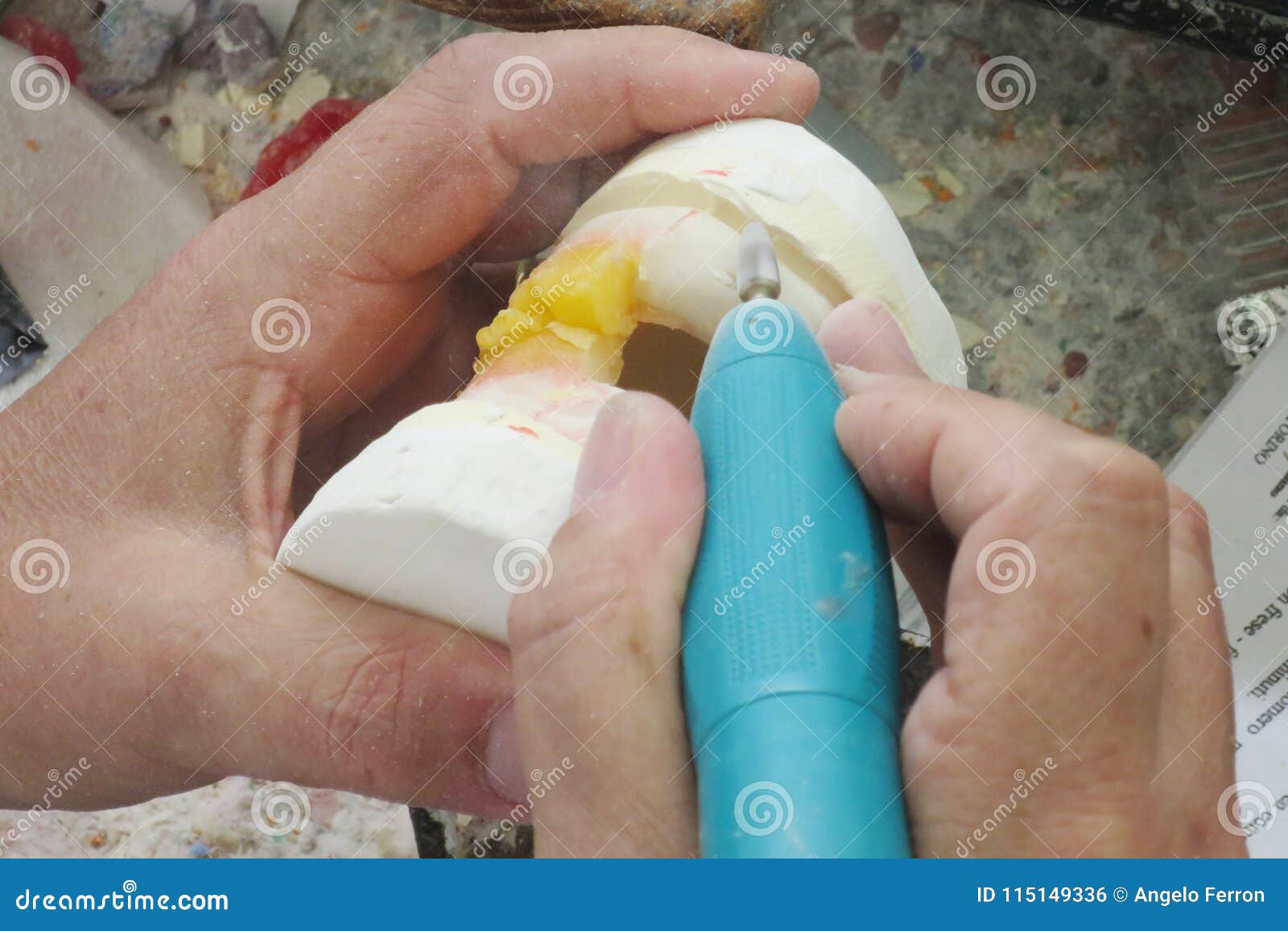 Dental Laboratory Equipment and Processing Stock Photo Image of