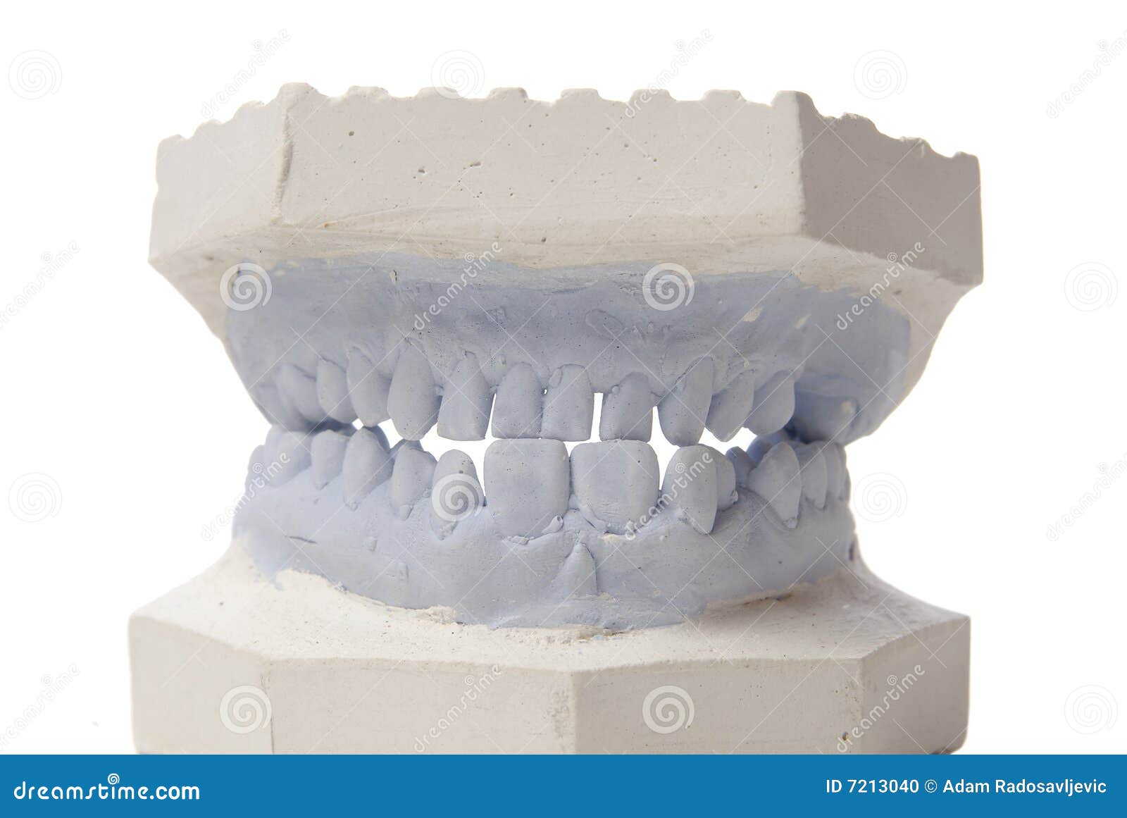 Dental model in plaster stock photo. Image of gypsum, care 7213040