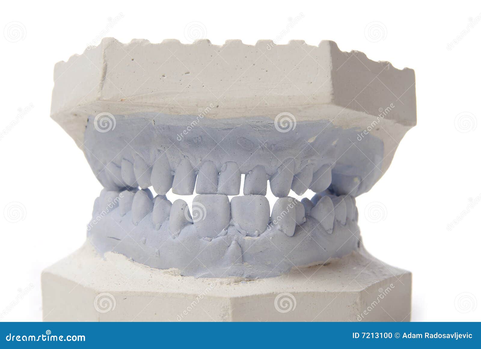 Dental model in plaster stock photo. Image of health, biology 7213100