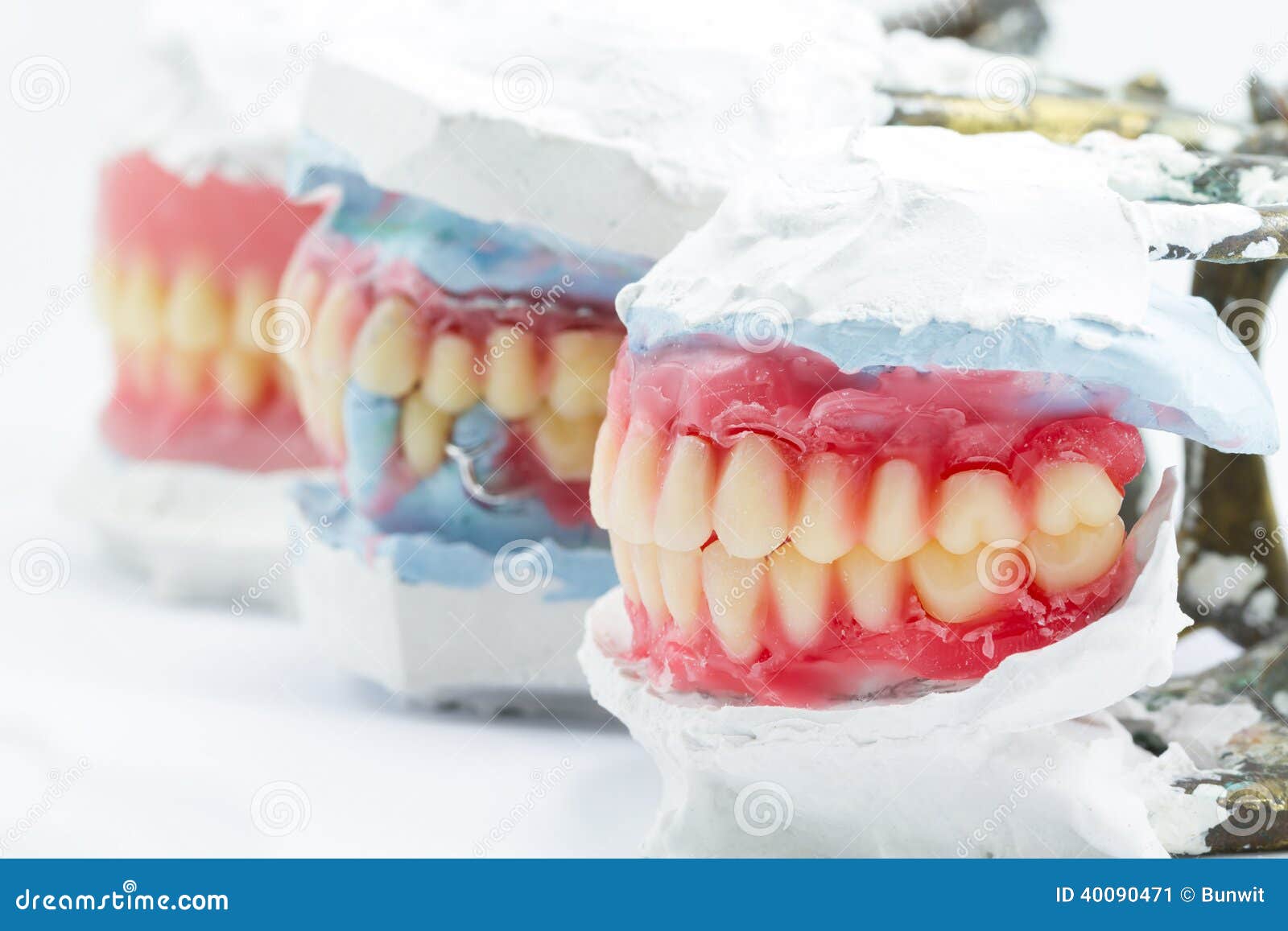 Dental Models Showing Different Types Stock Image Image of white