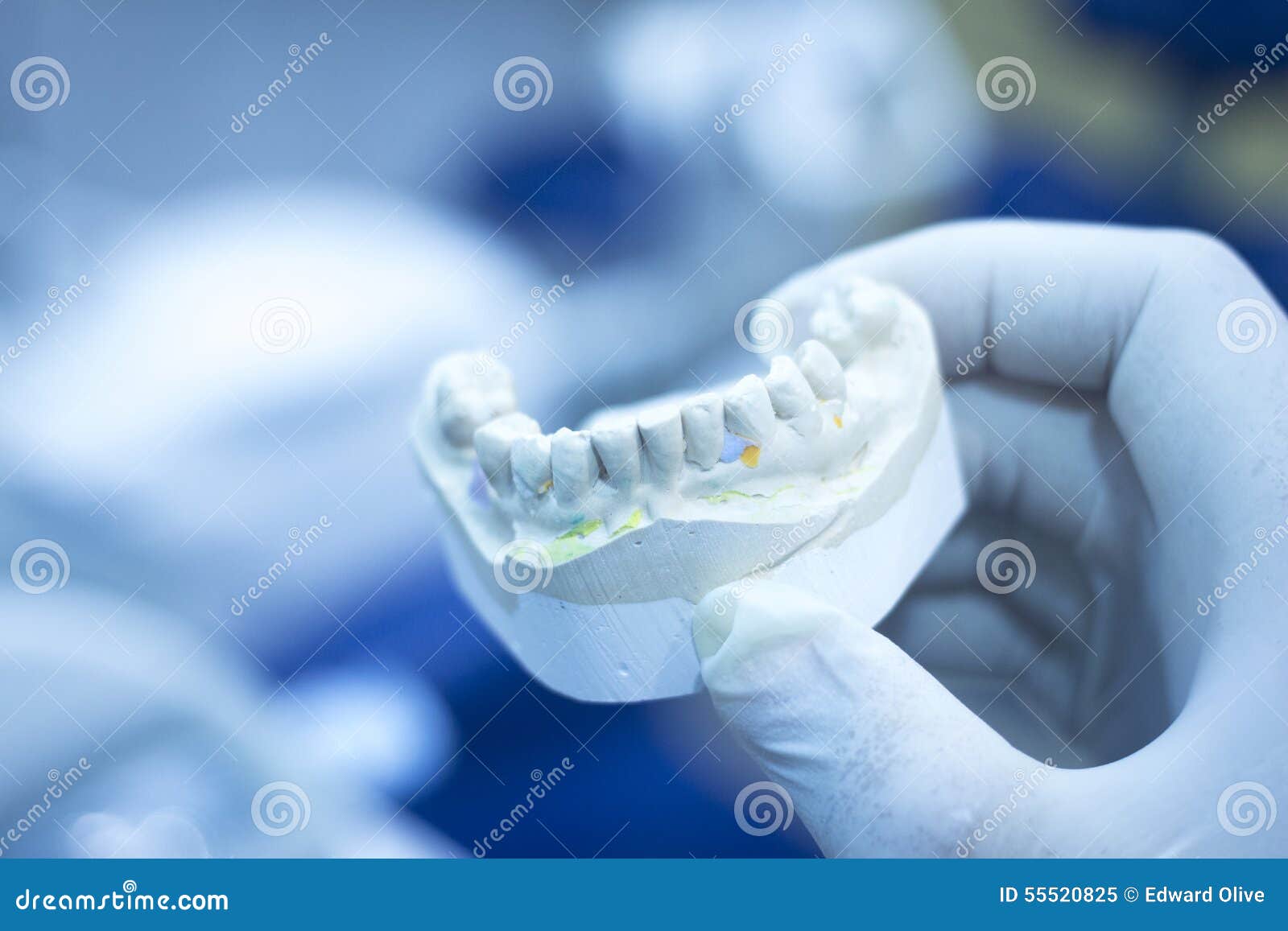 Dental Mold Dentist Clay Teeth Ceramic Plate Model Cast Stock Image - Image  of health, glove: 55520825