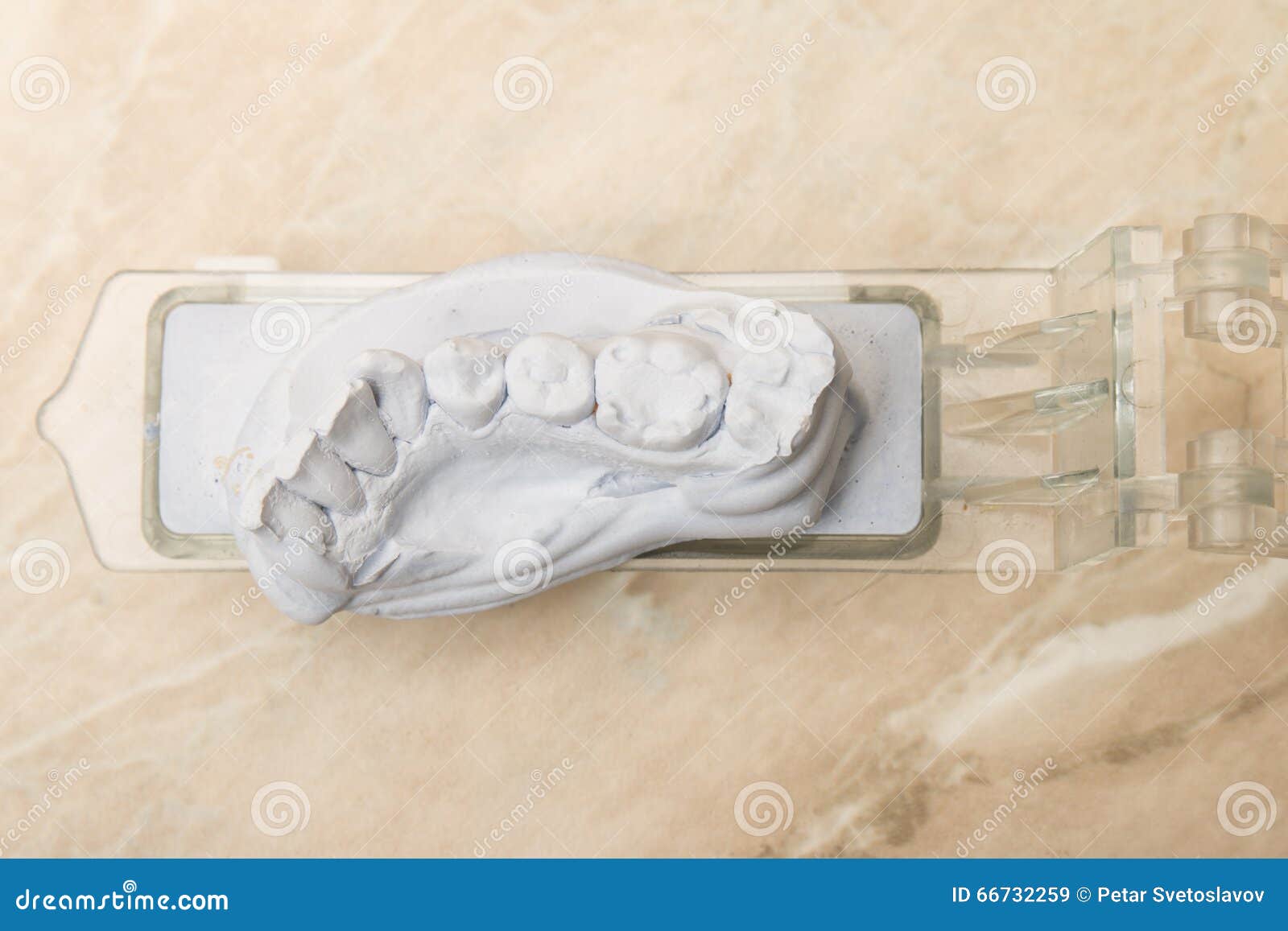 Dental Mold for Prosthetic Teeth Stock Image Image of cure, implants