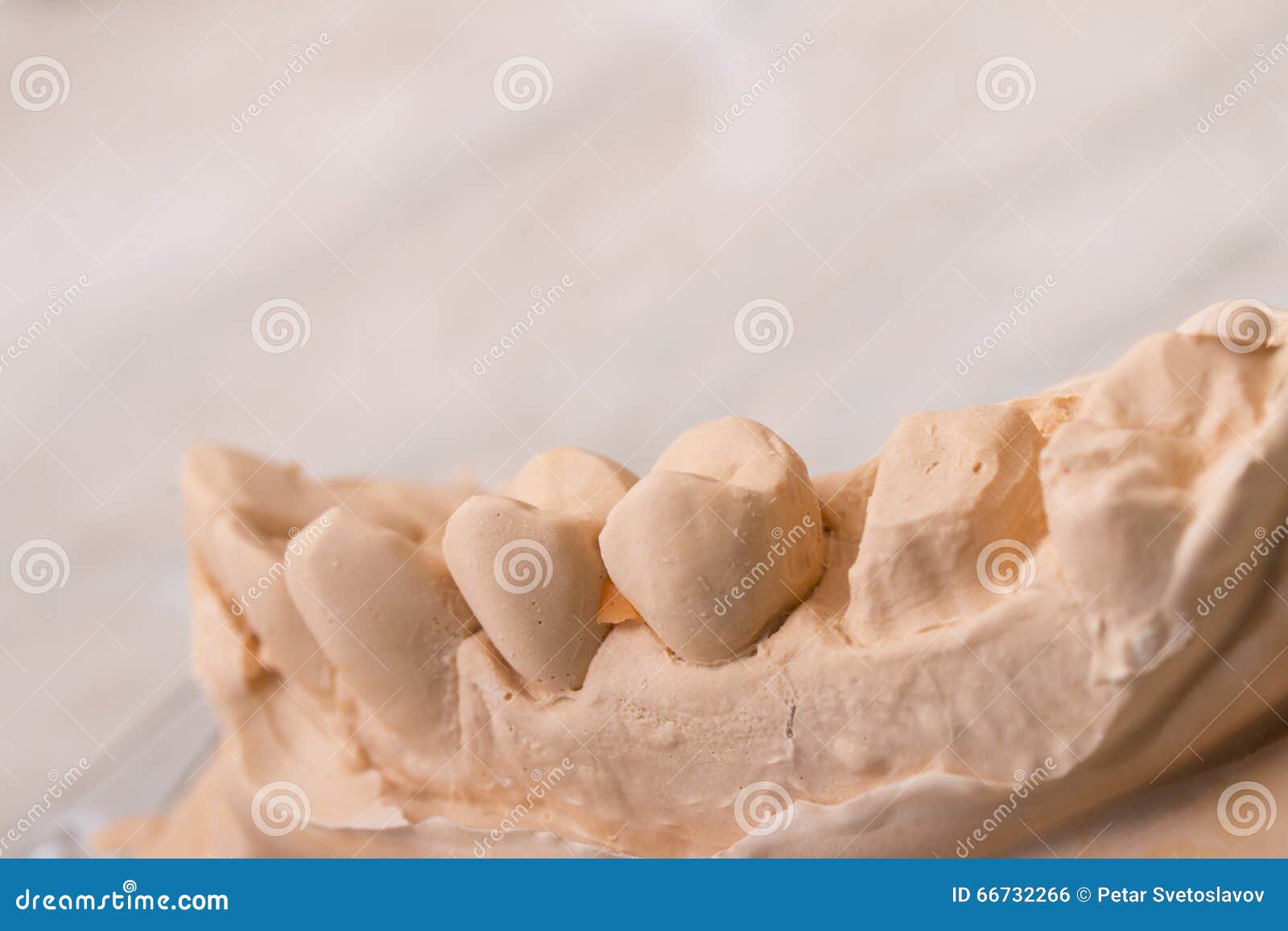 Dental Mold for Prosthetic Teeth Stock Photo Image of mold, macro