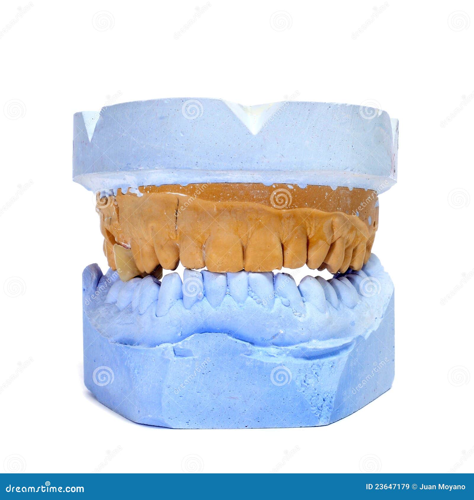 Dental mould stock image. Image of dental, dentist, mastication 23647179