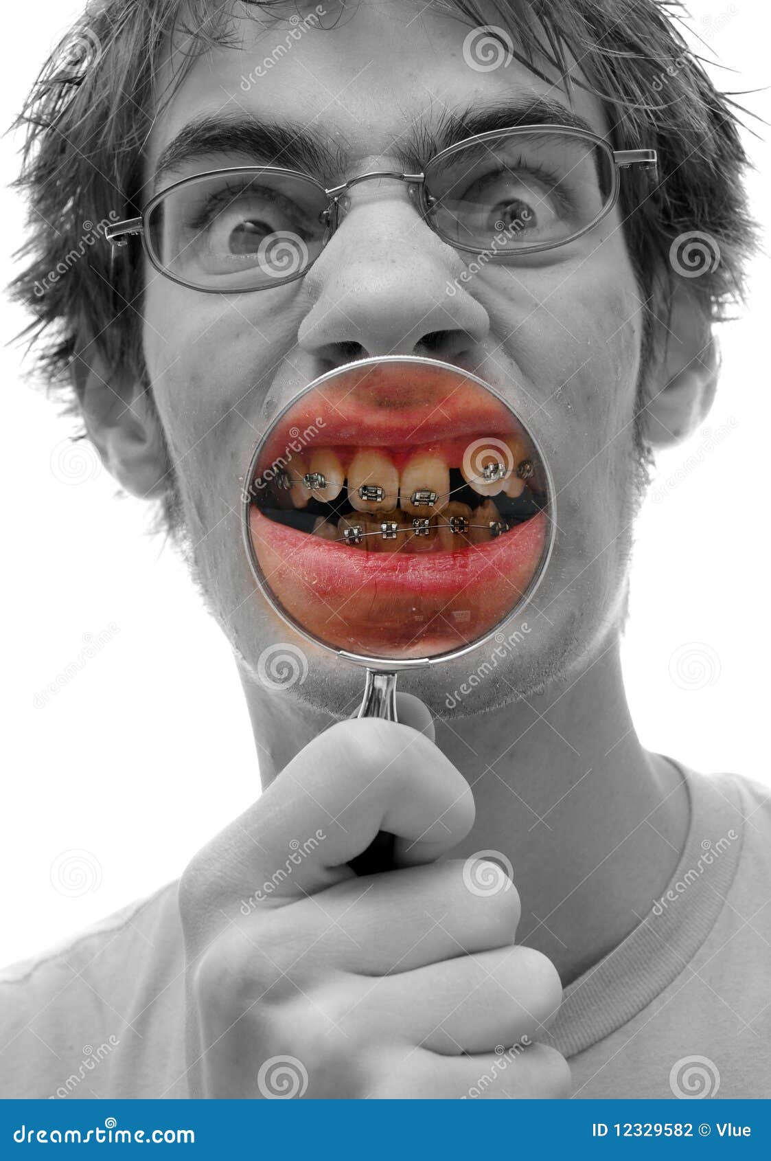 Dental Mouth Braces Inspection Stock Photo Image of large, crooked