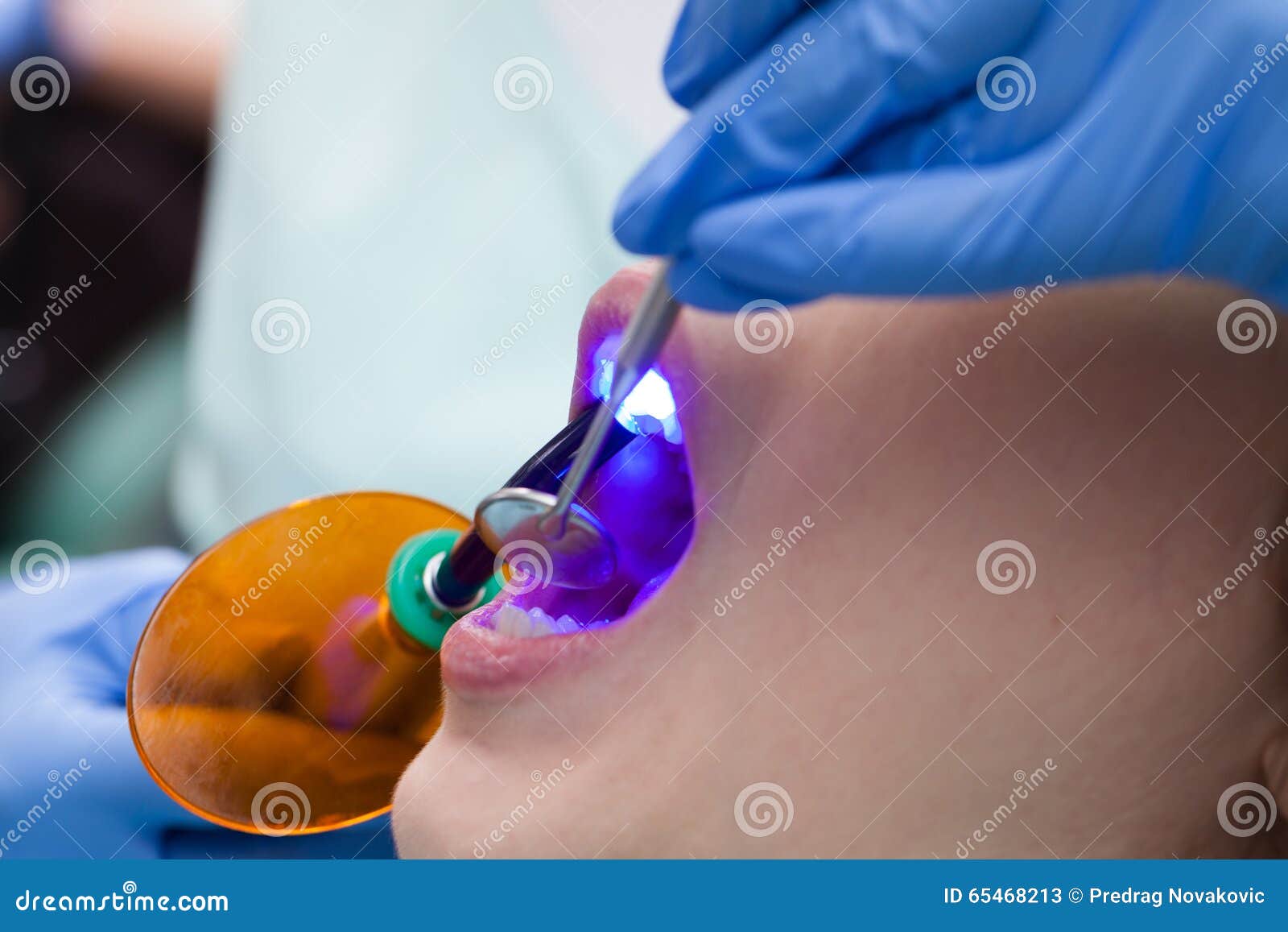 Dental obturation stock image. Image of dental, examining 65468213