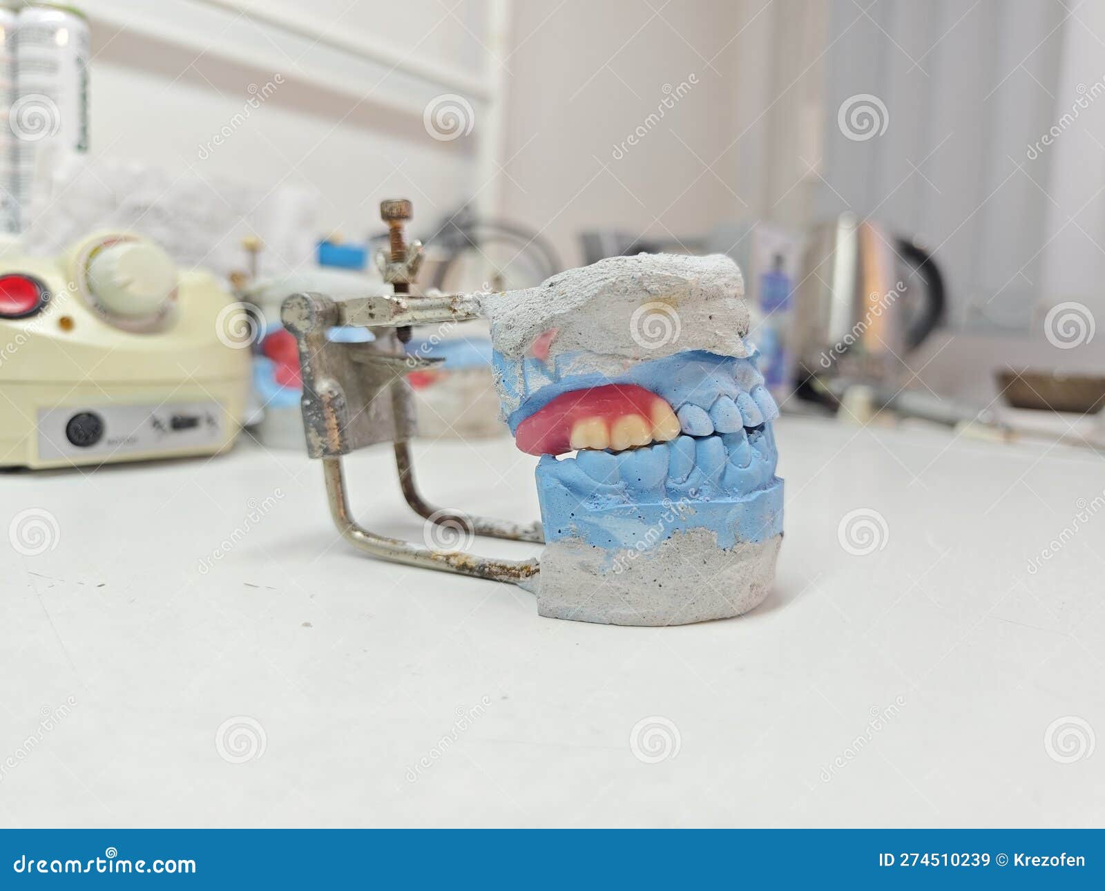 Dental Plaster Models with Denture Analogs in the Dental Laboratory