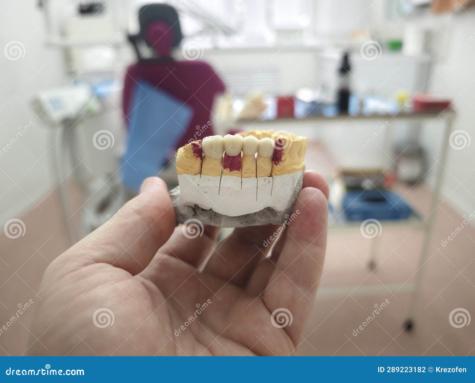 Dental Plaster Mould in the Hands of the Dentist Stock Photo Image of