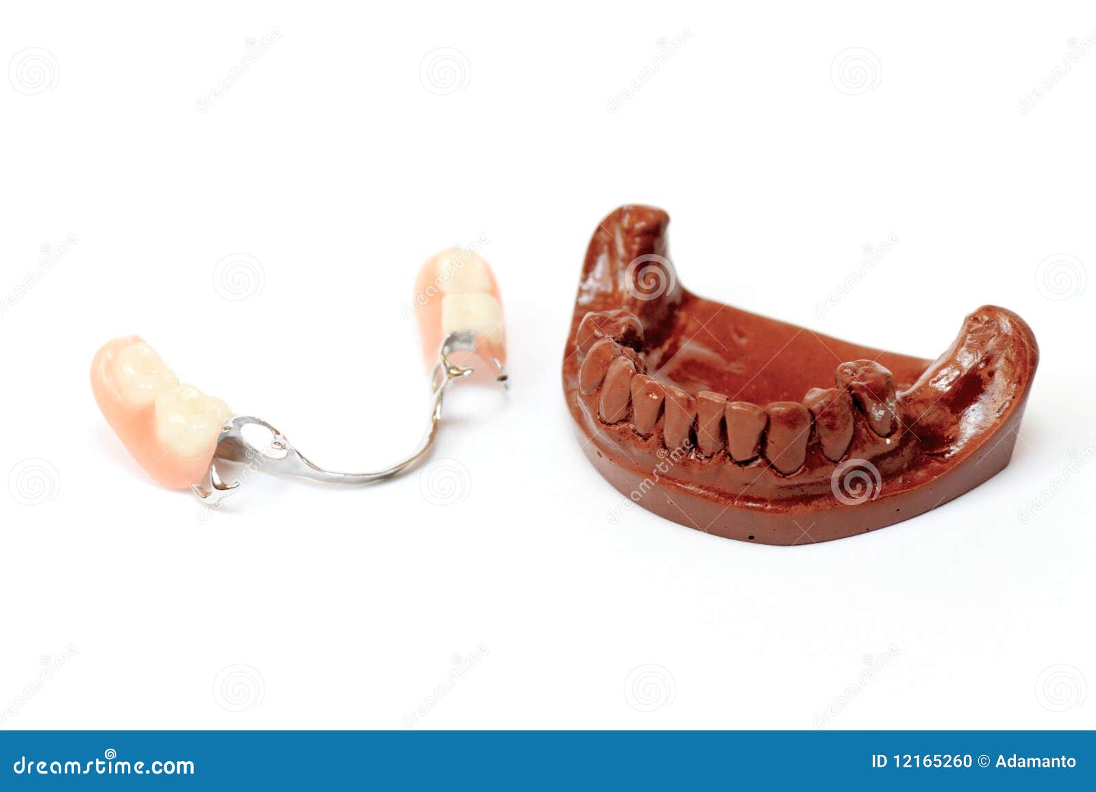 Dental Plaster Moulds, Dentures Stock Photo Image of shape, bridge