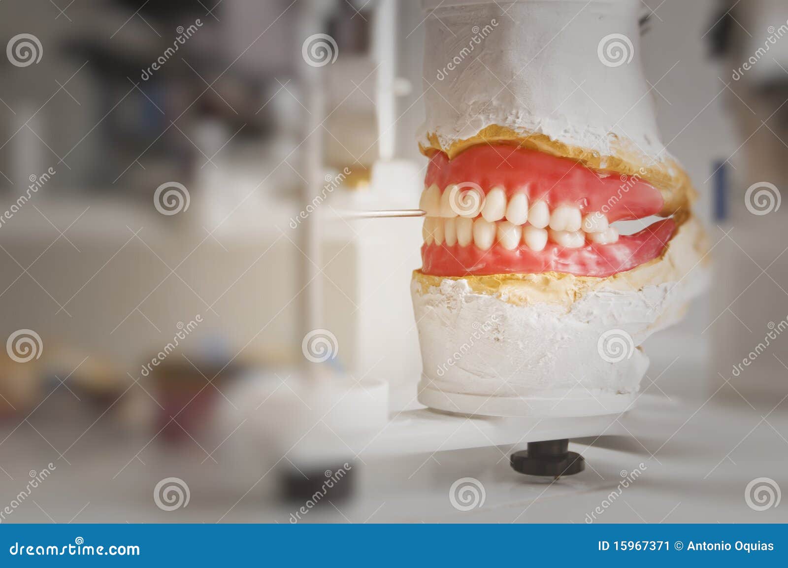 Dental Plate stock image. Image of cast, plate, moulding 15967371