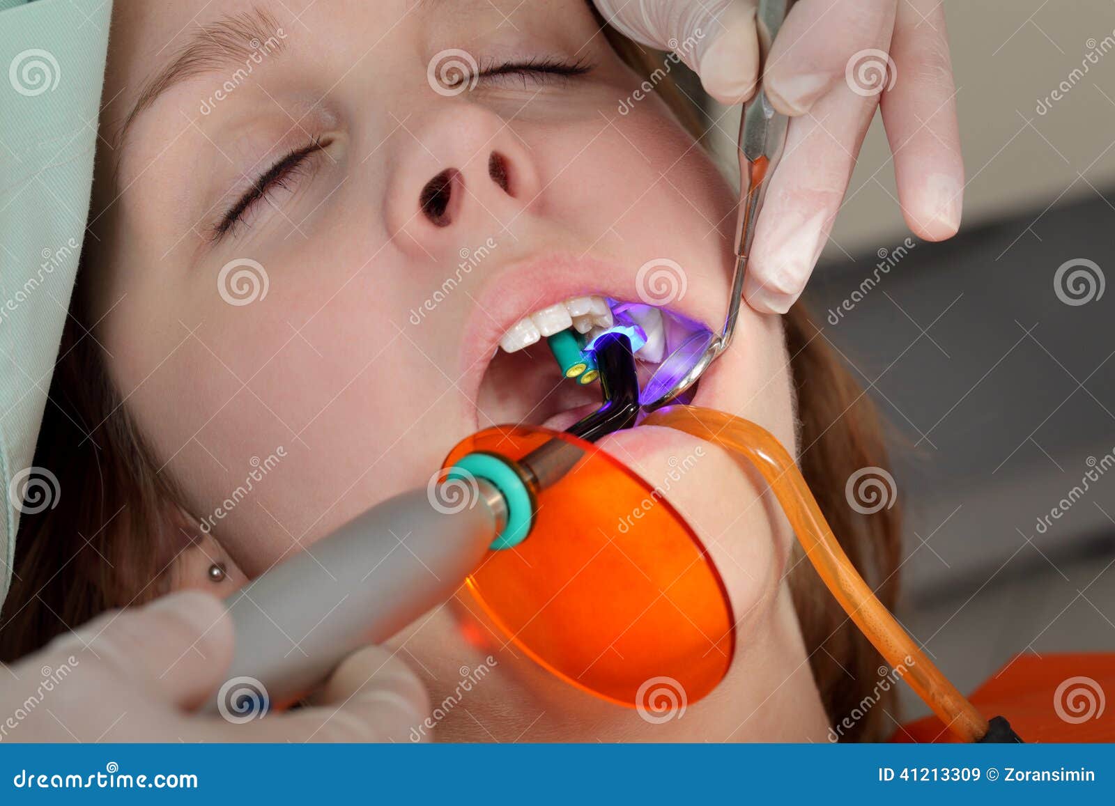 Dental procedure, laser stock image. Image of curing 41213309