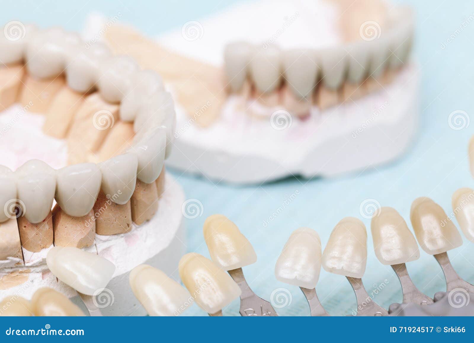 Dental Prostheses On A White Background. Beautiful Teeth Ceramic Press