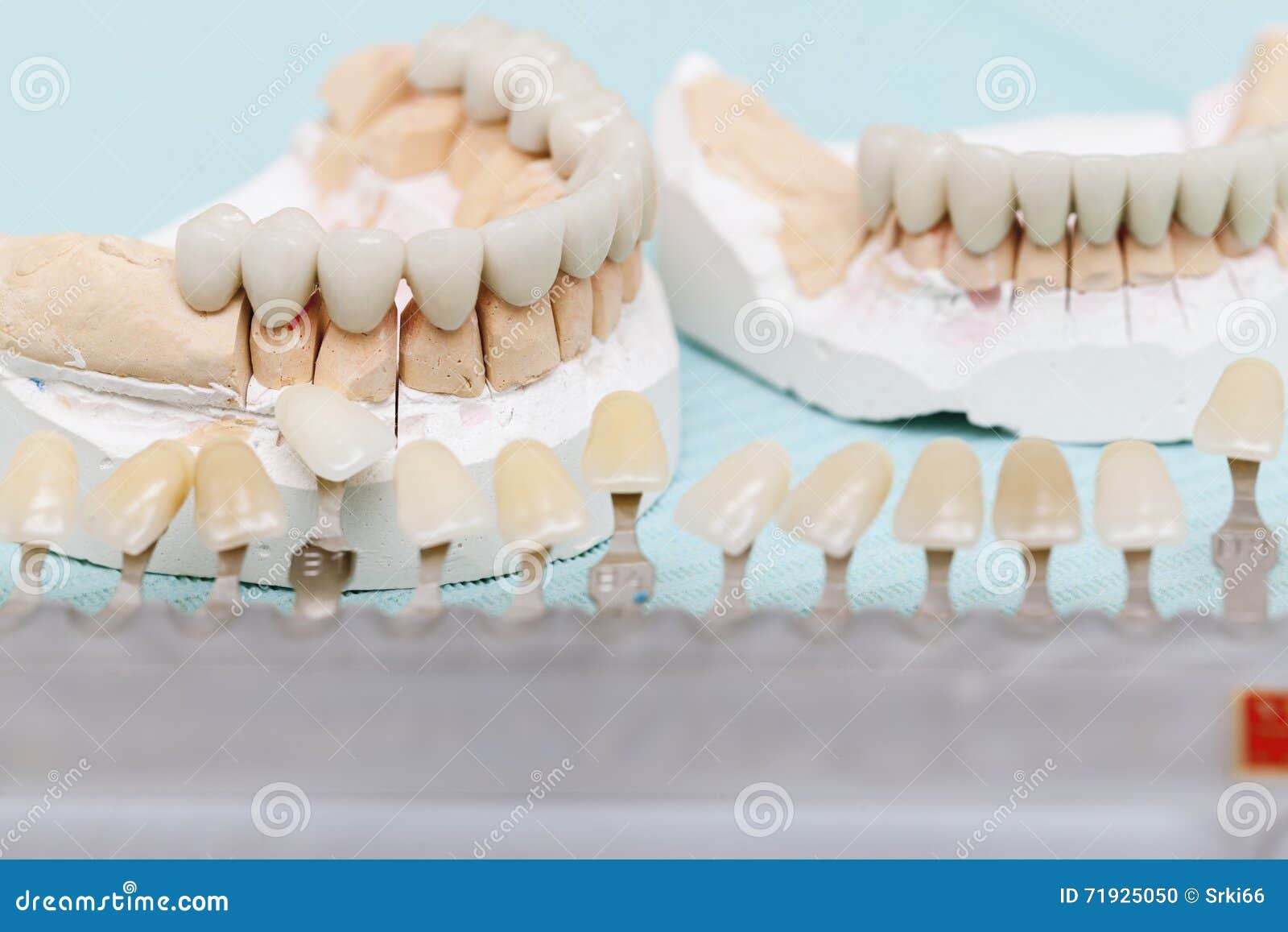 Dental Prostheses On A White Background. Beautiful Teeth Ceramic Press