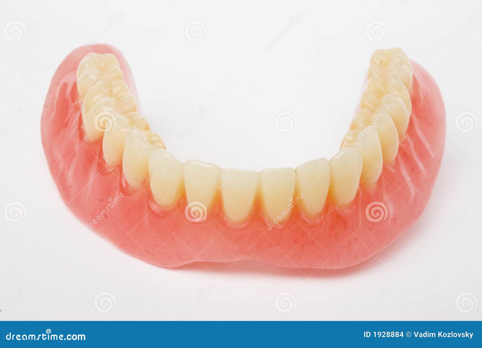Dental prosthesis stock photo. Image of health, dental 1928884