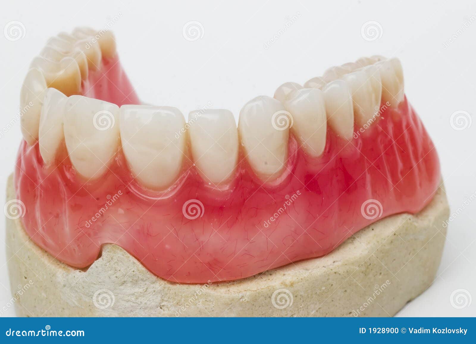 Dental prosthesis stock photo. Image of medical, doctor 1928900