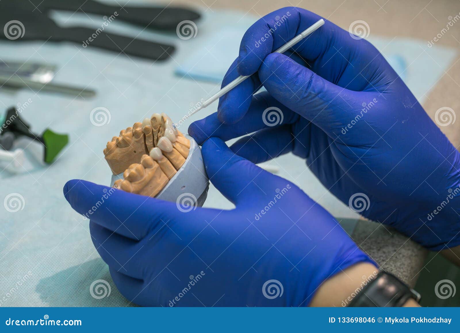 Dental Prosthesis, Dentures, Prosthetics Work. Prosthetics Hands while
