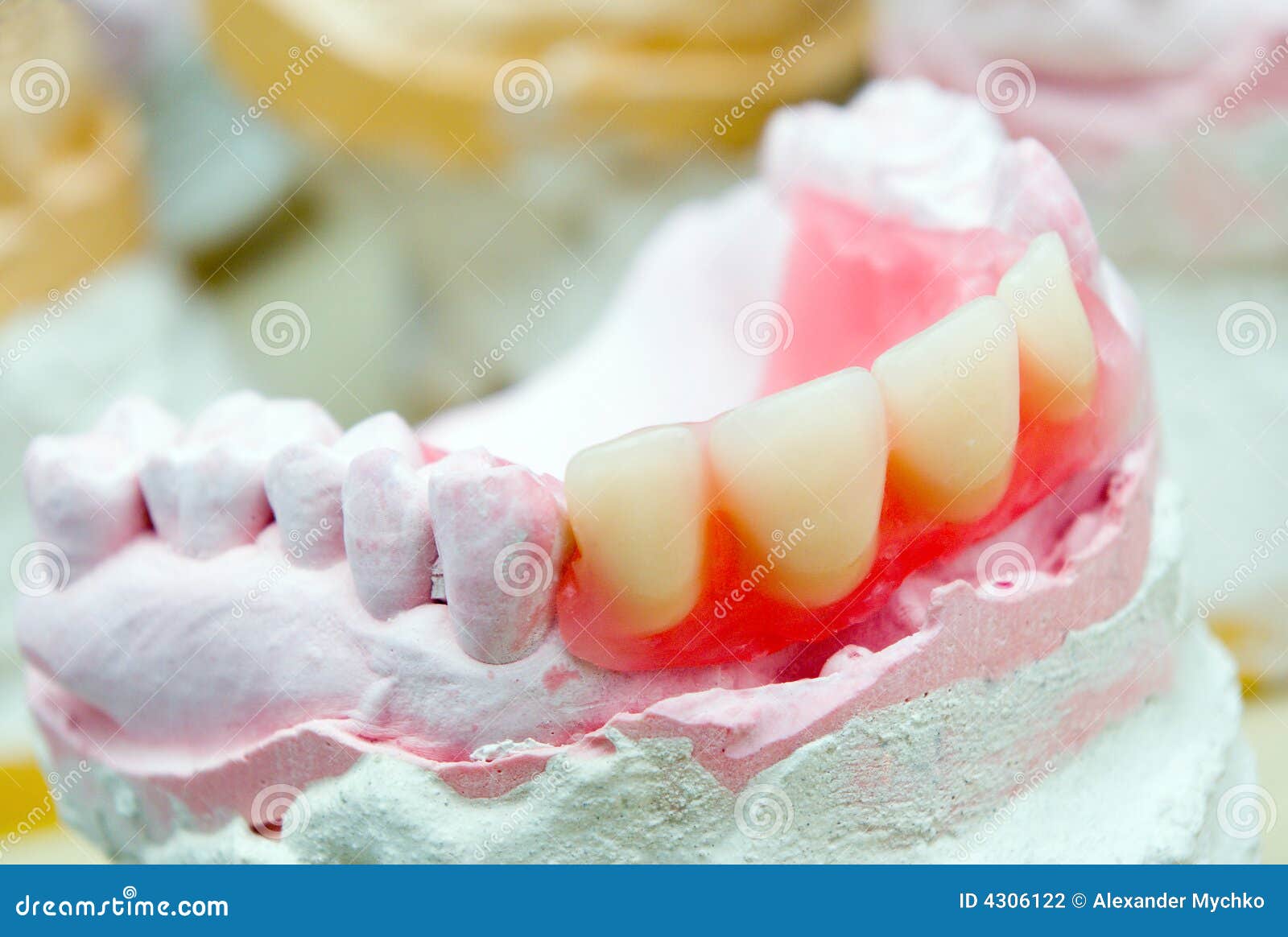 Dental prosthetic stock photo. Image of repair, medicine 4306122