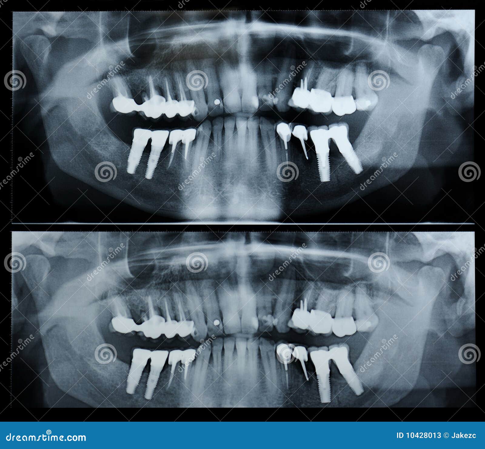 dental radiography