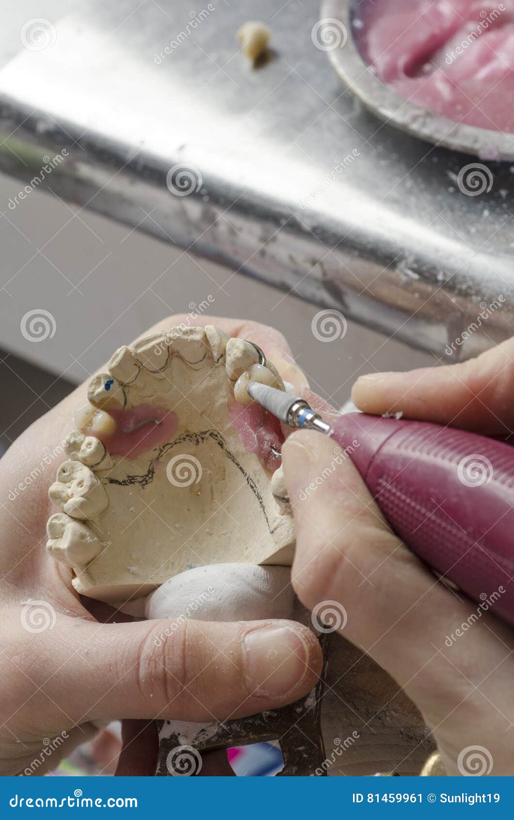 Dental Technician Doing Partial Dentures of Acrylic Resins. Stock Image