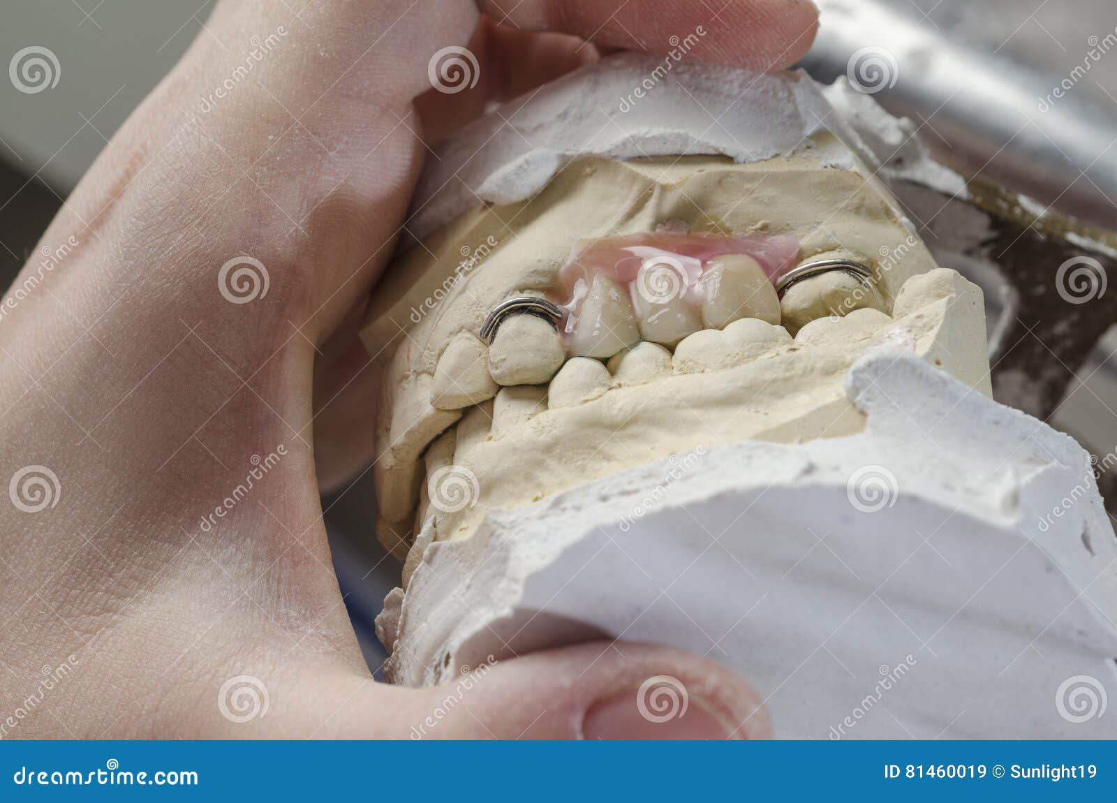 Dental Technician Doing Partial Dentures of Acrylic Resins. Stock Image