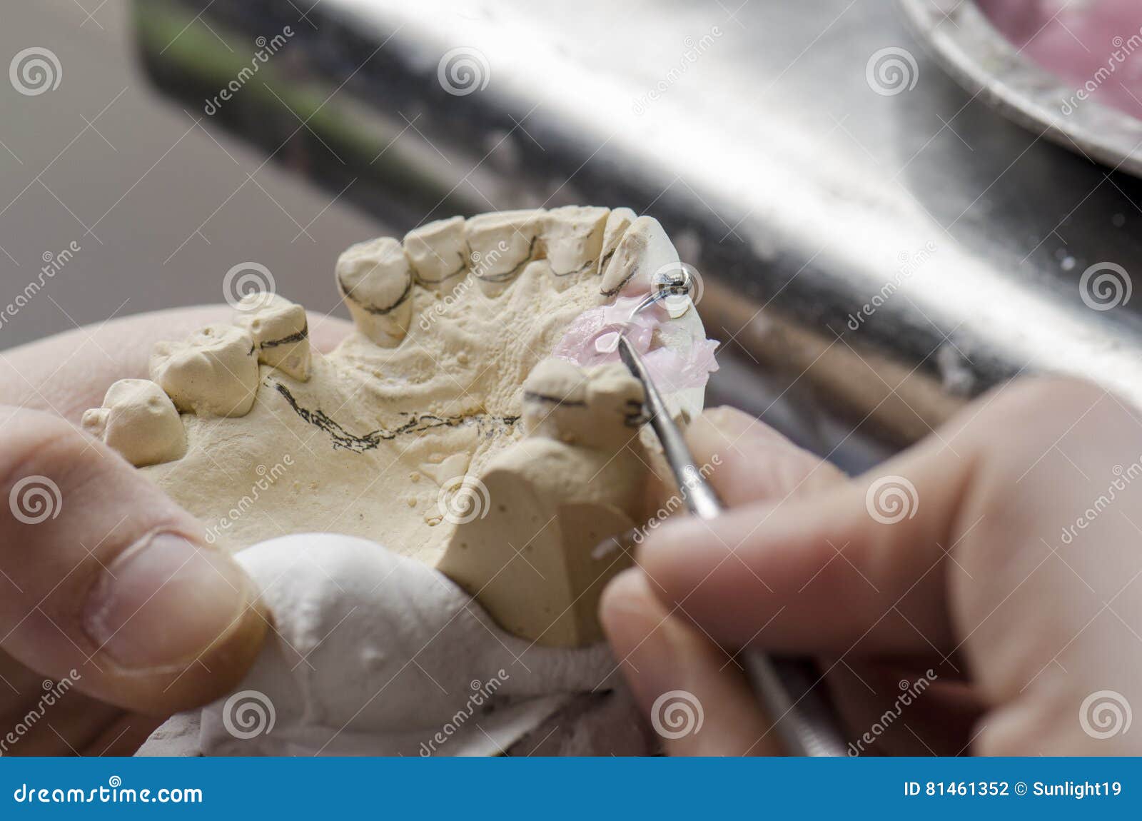 Dental Technician Doing Partial Dentures of Acrylic Resins. Stock Photo