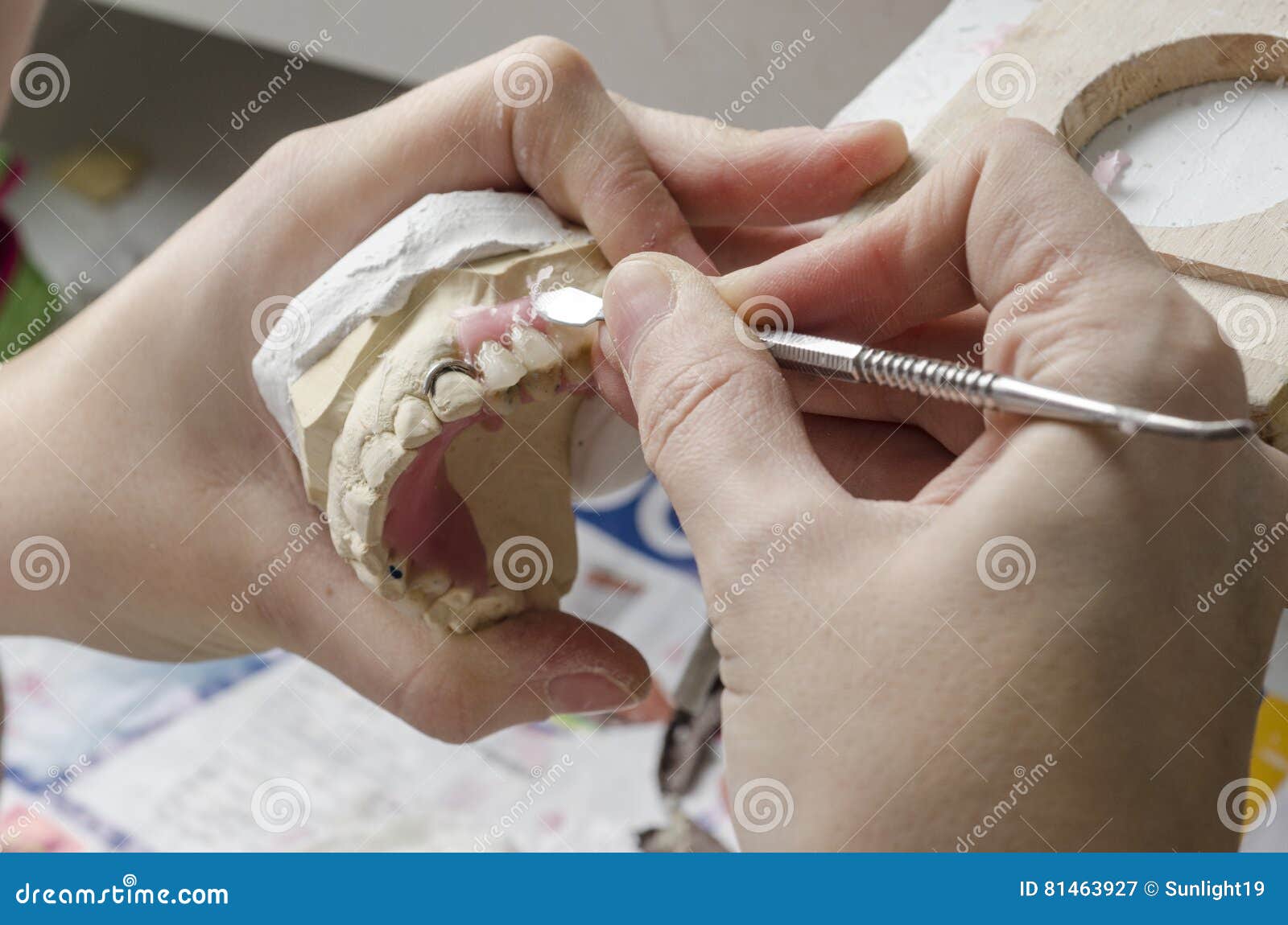 Dental Technician Doing Partial Dentures of Acrylic Resins. Stock Image