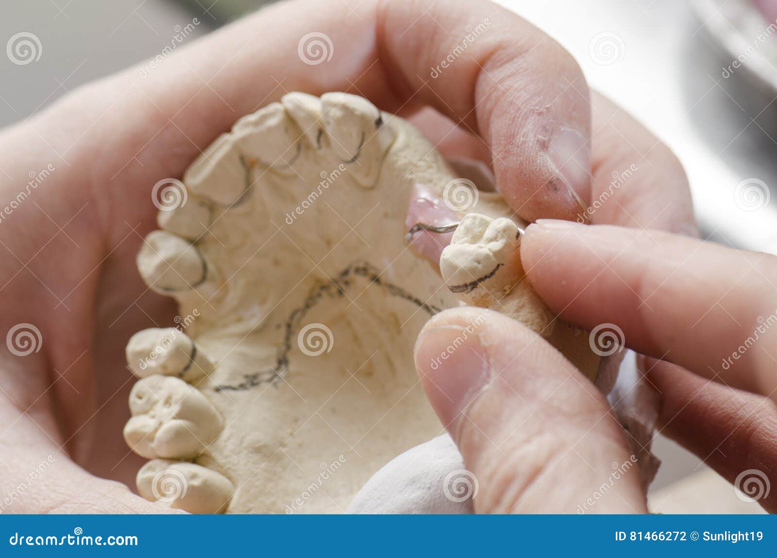 Dental Technician Doing Partial Dentures of Acrylic Resins. Stock Photo