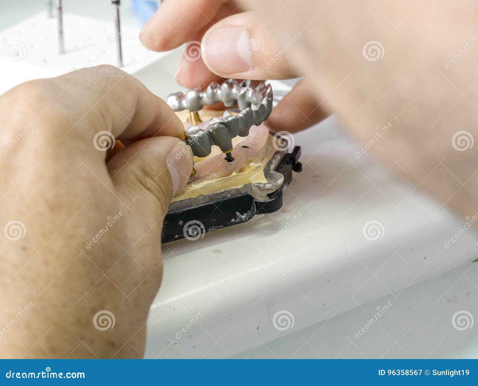 Dental Technician Making a Metal Structure of a Dental Crown or Stock
