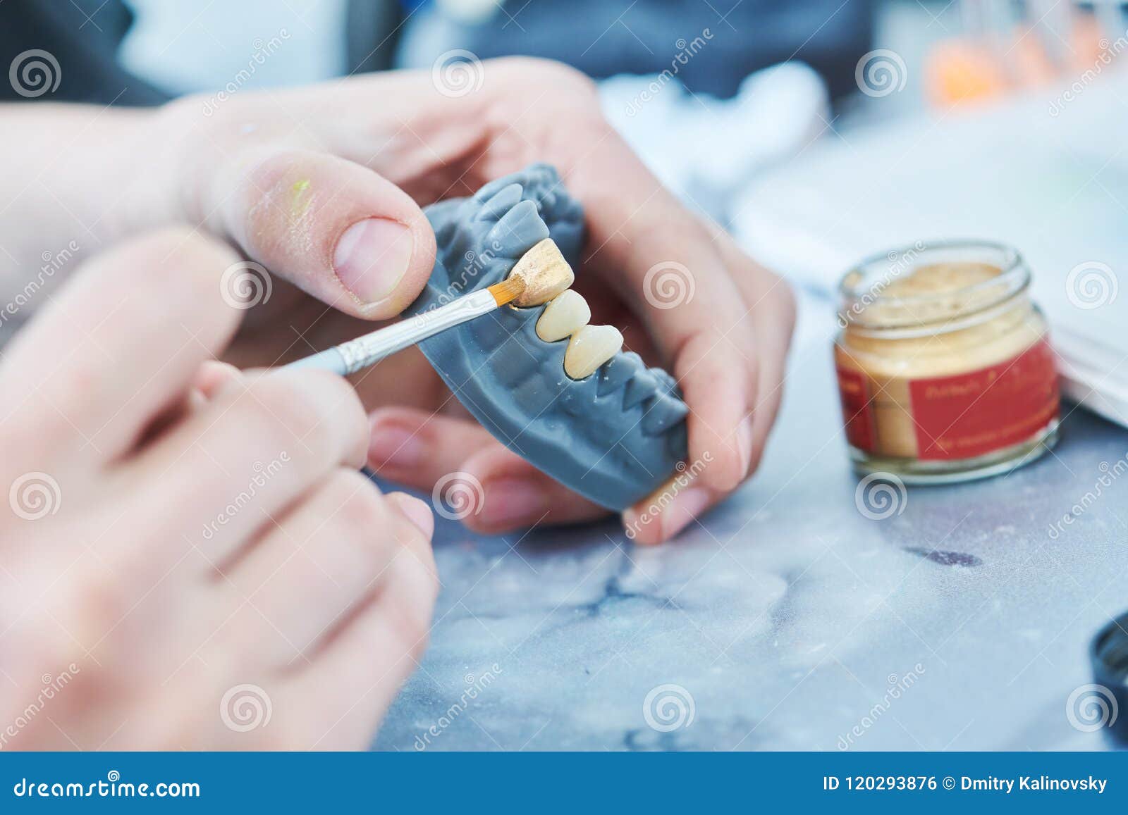 Dental Technician Work. Prosthesis Production. Teeth Prototype