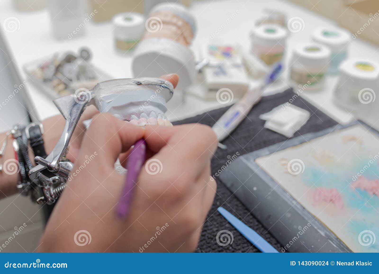 Dental Technician Working on Plaster Stone Model with Zirconium Bridge