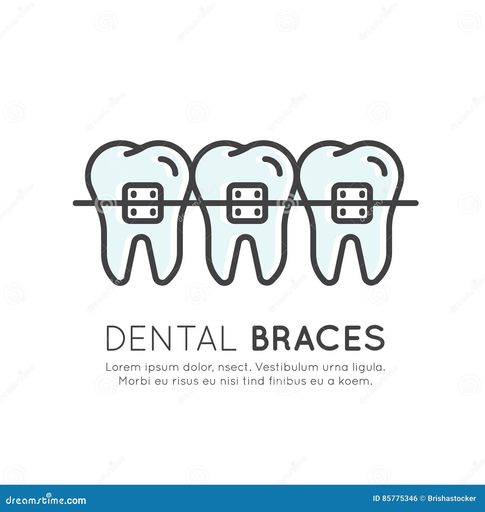 dental tooth braces installation process, aesthetics, orthodontist