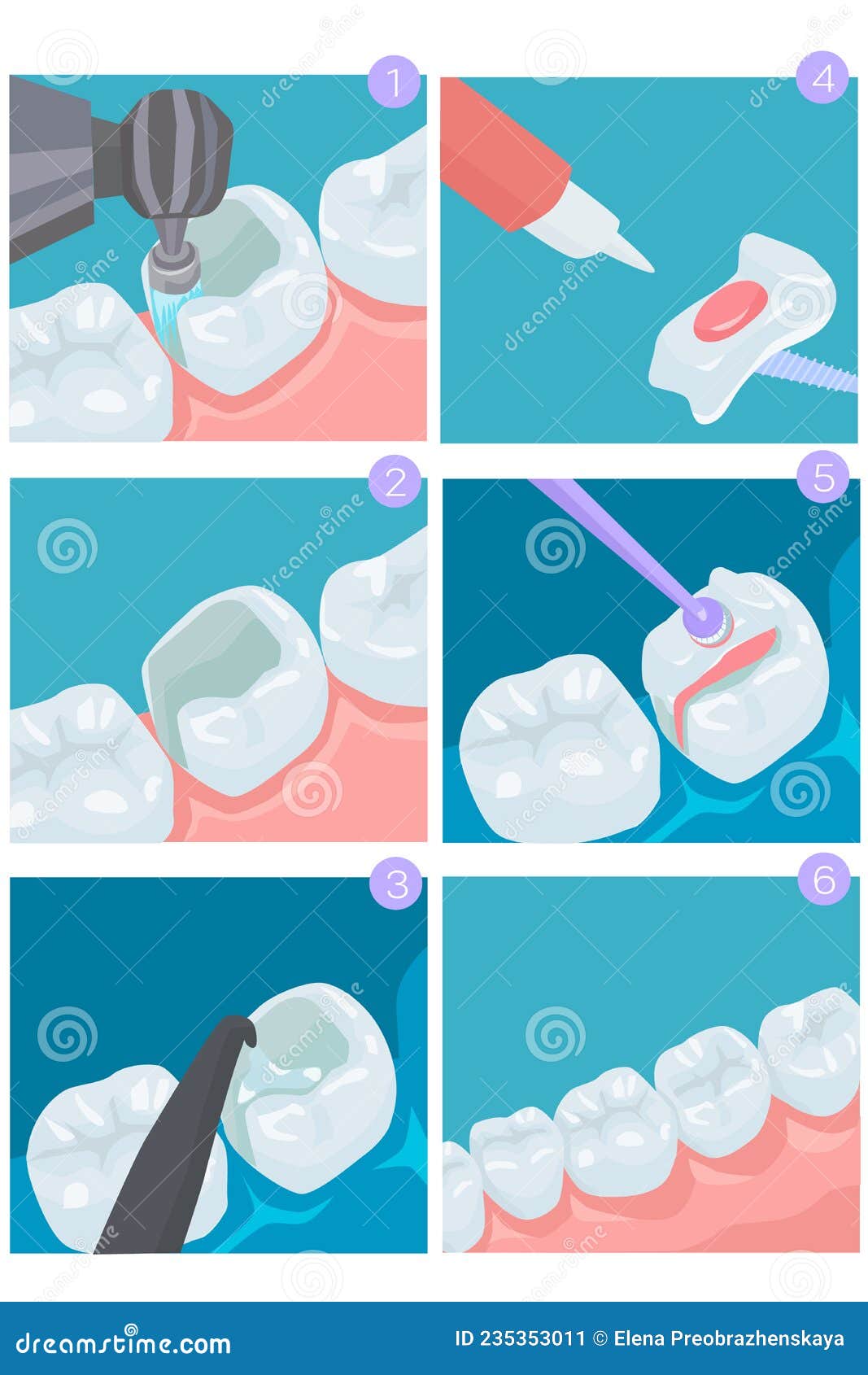 Dental Treatment. Installing a Tab, Step by Step Instructions. Dental