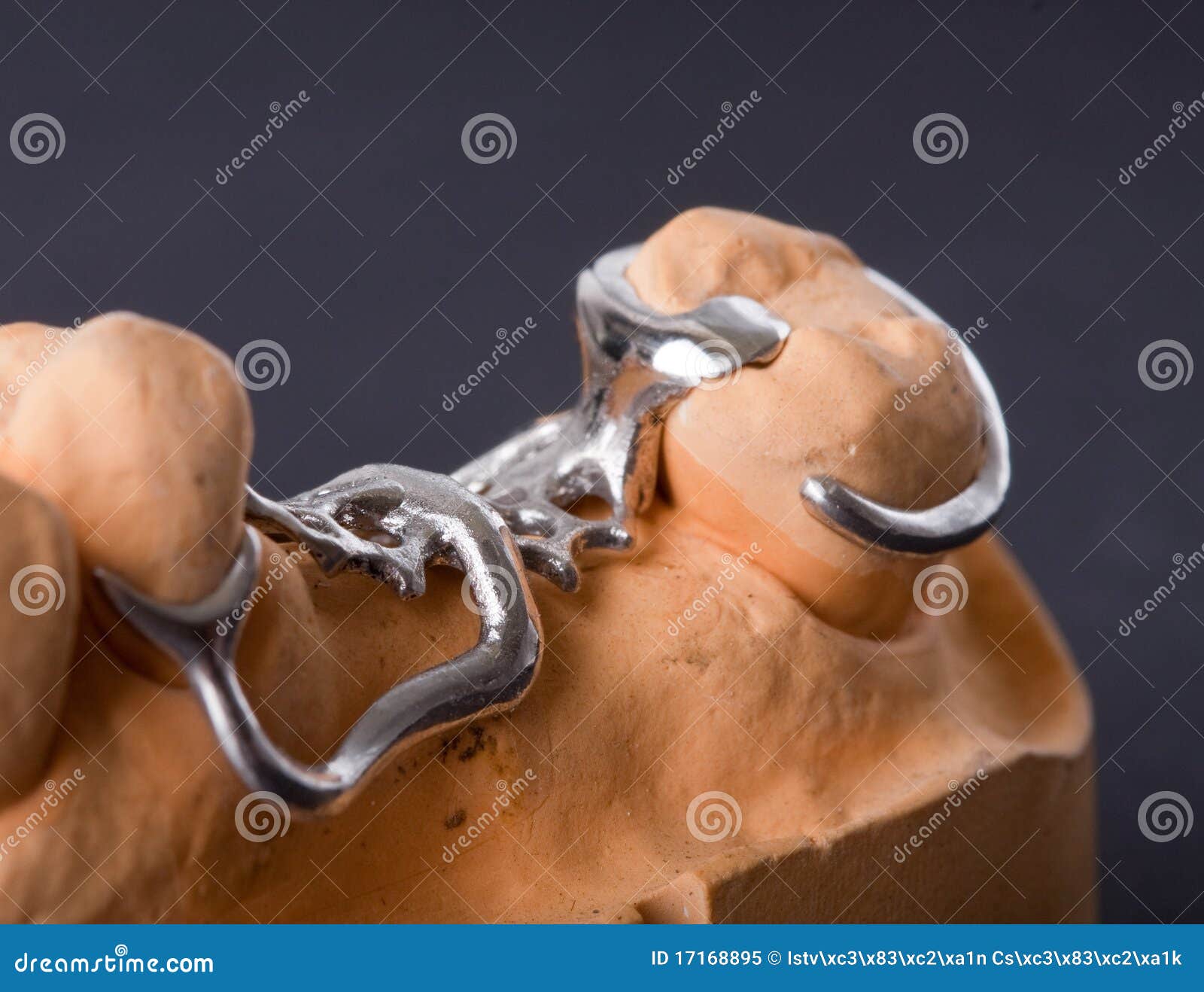 Dental wax model stock image. Image of dentist, molars 17168895